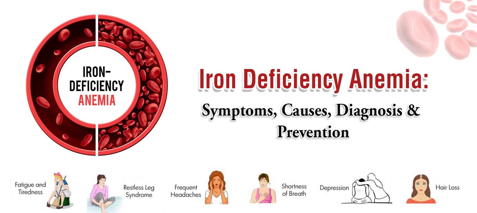 A medical infographic titled "Iron Deficiency Anemia: Symptoms, Causes, Diagnosis & Prevention," displaying an illustration of red blood cells in a circle and various symptoms like fatigue, restless legs, headaches, shortness of breath, depression, and hair loss.