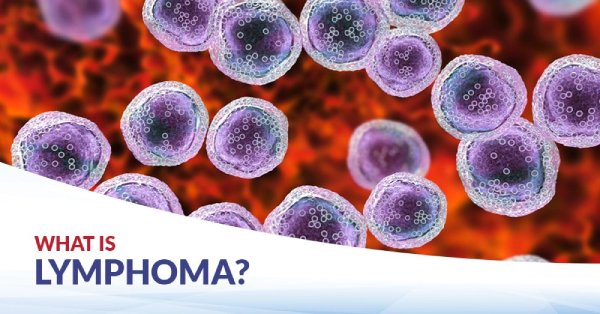 A microscopic illustration showing numerous large, purple, irregular cells, typical of lymphoma, against a textured orange-red background, with the text "WHAT IS LYMPHOMA?" on a white and blue banner at the bottom left.