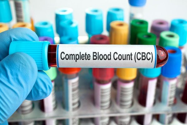 A close-up photo of a medical test tube labeled "Complete Blood Count (CBC)" held by a hand in a blue medical glove, with many other test tubes in racks in the background.