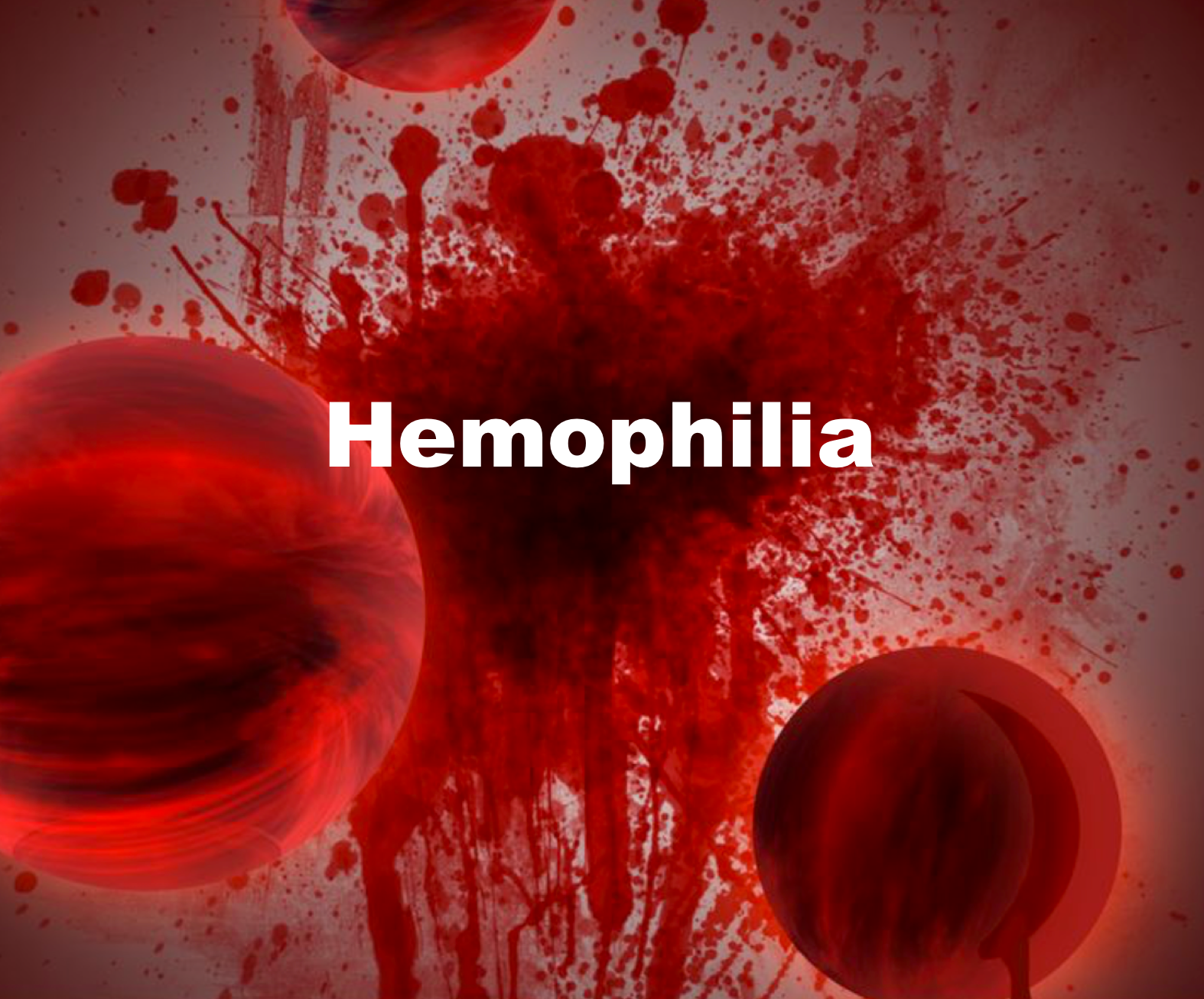 A graphic with the word "Hemophilia" in white text overlaid on a blood-splatter background with blurry red spheres.